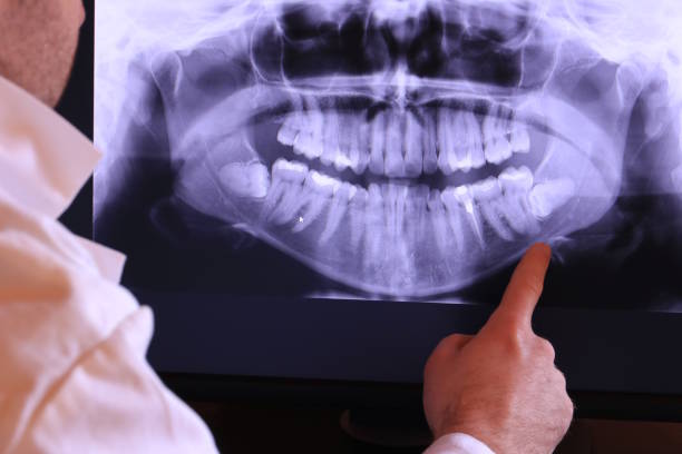 Best Cosmetic Emergency Dentistry in St Francis, MN