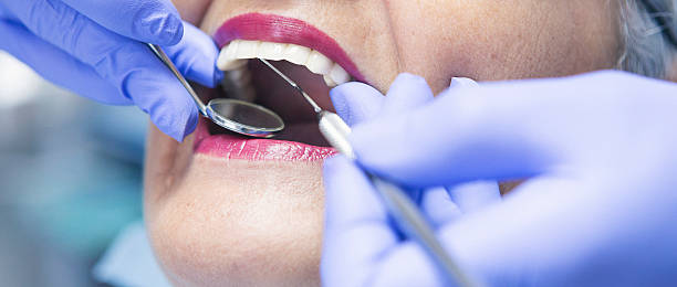 Best Emergency Tooth Extraction in St Francis, MN